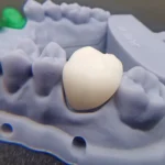 dental-temporary-cb-resin-1